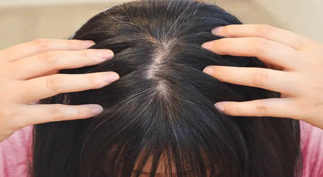 Solusi Rambut Sehat: Bedah Tuntas Penyebab Uban Sebelum Usia 30