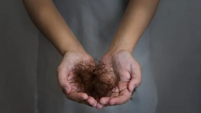 13 Penyebab dan Solusi Rambut Rontok yang Perlu Diketahui