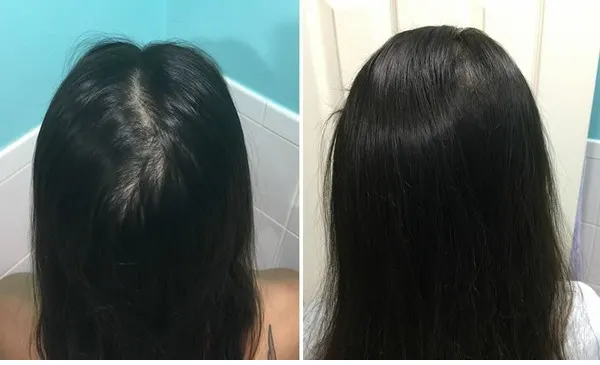 Rahasia Hair Care Modern: Tren Perawatan yang Terbukti Ampuh Menumbuhkan Rambut Rontok
